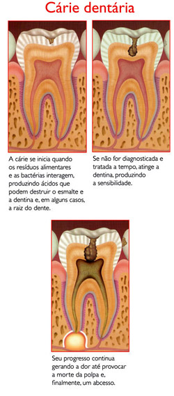 foto colunas